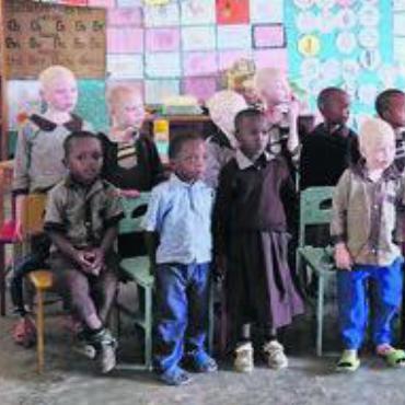 Helfen, wo immer es geht - Besonders sie brauchen Schutz und Hilfe: Albino- und beeinträchtigte Kinder.